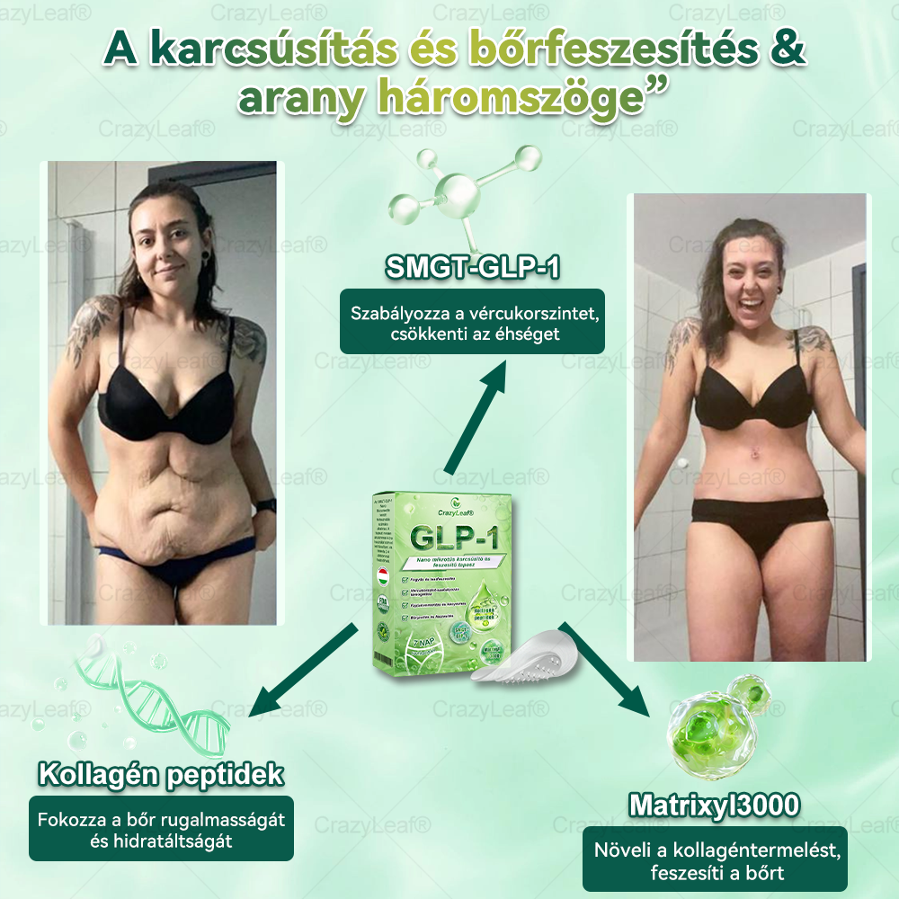 │Hivatalos webáruház│🌿 CrazyLeaf® SMGT-GLP-1 Nano Mikrotűs Tapasz 👉Természetes segítség túlsúly, fáradtság, bőr- és ízületi problémák ellen.