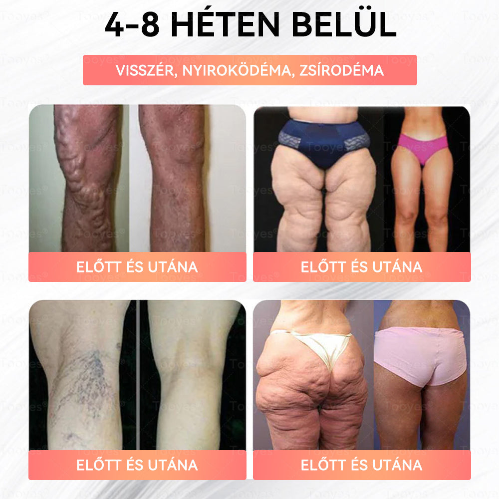 Hivatalos webáruház – Tooyes® GLP-1 Magas Koncentrációjú Folyékony Gyöngyök – NAD+, Moringa, HCA összetevőkkel (Fogyás, Öregedésgátlás, Bél- és Immunrendszer támogatás, Vércukorszint egyensúly, Szív- és Agyegészség)