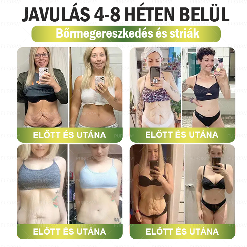 │Hivatalos webáruház│🌿 CrazyLeaf® SMGT-GLP-1 Nano Mikrotűs Tapasz 👉Természetes segítség túlsúly, fáradtság, bőr- és ízületi problémák ellen.