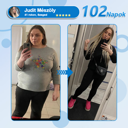 🎉 Gratulálunk! Ma te lettél a szerencsés vásárlónk! Ez alkalomból extra 50% kedvezményt adunk neked! Ne szalaszd el ezt a lehetőséget – ha ma nem élsz vele, lehet, hogy csak jövőre lesz újra ilyen esélyed!🔥FormaÉlet®