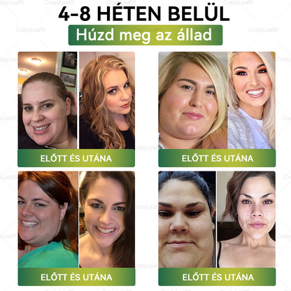 │Hivatalos webáruház│🌿 CrazyLeaf® SMGT-GLP-1 Nano Mikrotűs Tapasz 👉Természetes segítség túlsúly, fáradtság, bőr- és ízületi problémák ellen.