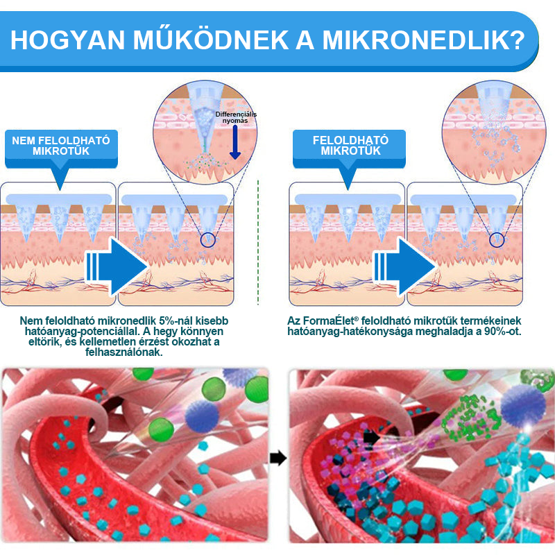 🎉 Gratulálunk! Ma te lettél a szerencsés vásárlónk! Ez alkalomból extra 50% kedvezményt adunk neked! Ne szalaszd el ezt a lehetőséget – ha ma nem élsz vele, lehet, hogy csak jövőre lesz újra ilyen esélyed!🔥FormaÉlet®