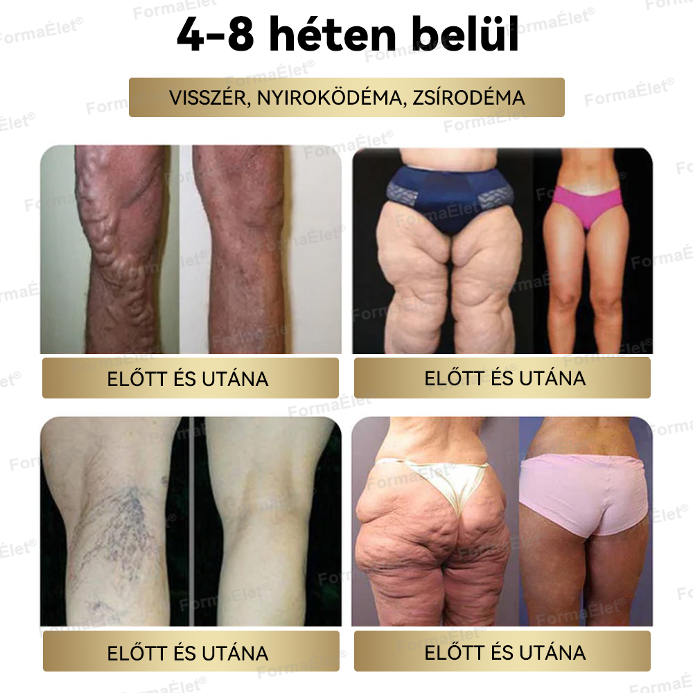 FormaÉlet® GLP-1 Moringa Fogyókúrás és Egészségfokozó cseppek  (⭐Élelmiszer-minőségű zsírégető – Az Obesity Society fejlesztése)