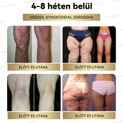 FormaÉlet® GLP-1 Moringa Fogyókúrás és Egészségfokozó cseppek  (⭐Élelmiszer-minőségű zsírégető – Az Obesity Society fejlesztése)