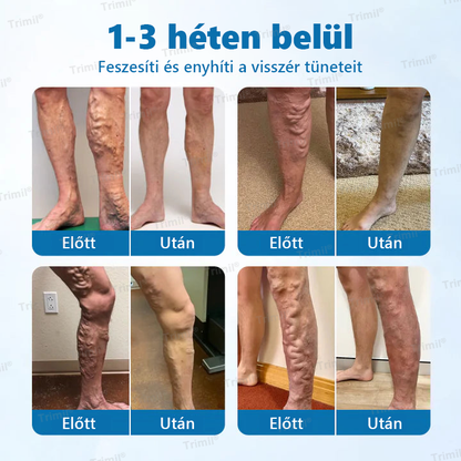 Trimil® VeinGuard Gyógynövényes Spray — 🎯Klinikailag bizonyított, hogy mindössze 7 nap alatt megszünteti a visszereket!