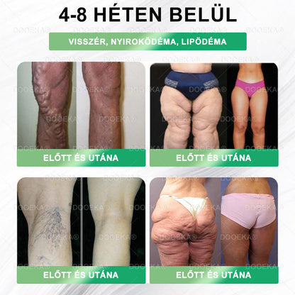𝐷𝑂𝑂𝐸𝐾𝐴® GLP-1 8 az 1-ben Fit & Vital Szájon át szedhető oldat – ✔ Napi egyszer, 7 nap alatt látható változás / Elhízás, szív- és érrendszeri egészség, cukorbetegség, alvási apnoe, bélrendszer egészsége, ízületi problémák és még sok más esetén